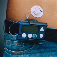 Insulin Pump